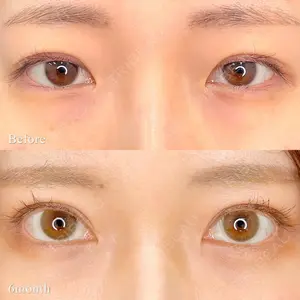 before image