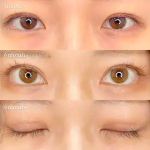 180 days after image