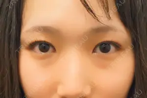 160 days after image