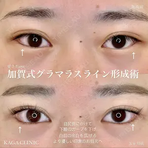 90 days after image