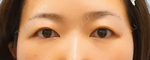 before image