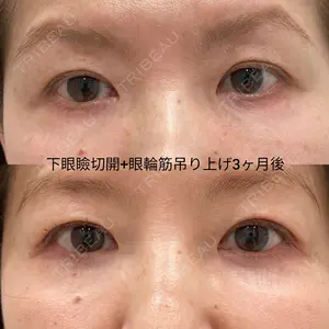 90 days after image