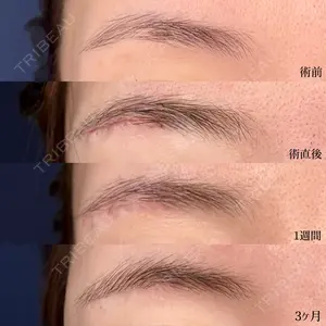 90 days after image