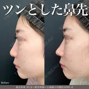 90 days after image