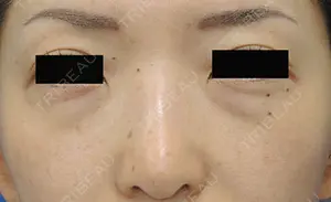 before image
