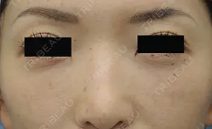 90 days after image