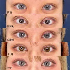 90 days after image