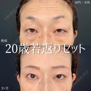 90 days after image