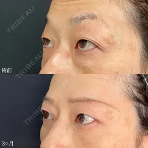 90 days after image