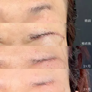 90 days after image