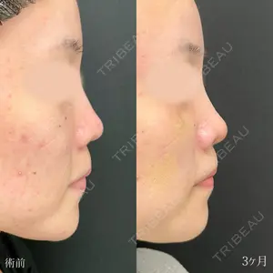 90 days after image