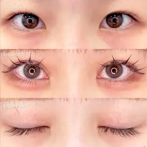 180 days after image