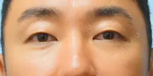 21 days after image