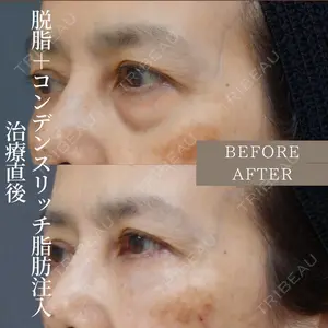 before image