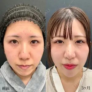 90 days after image