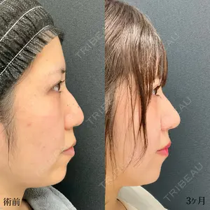 90 days after image