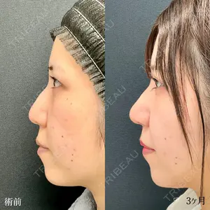 90 days after image