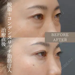 before image