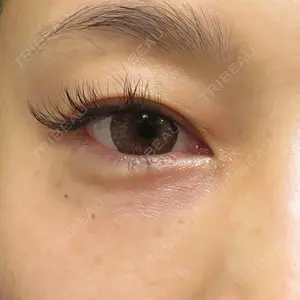 19 days after image