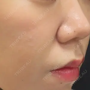 32 days after image