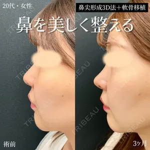 90 days after image