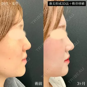 90 days after image