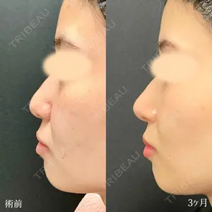 90 days after image