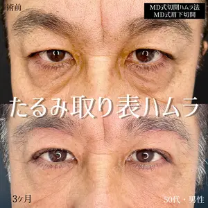 90 days after image