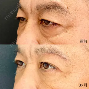 90 days after image