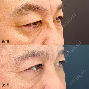 90 days after image