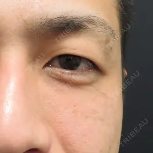 27 days after image