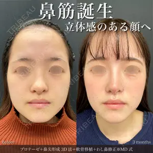 90 days after image