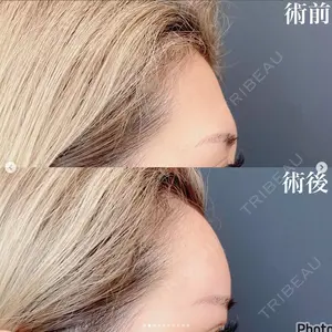 before image