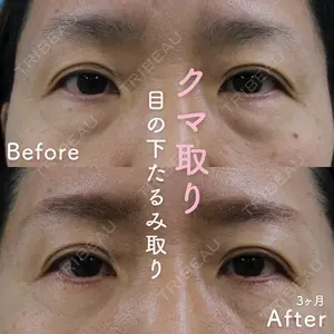 90 days after image