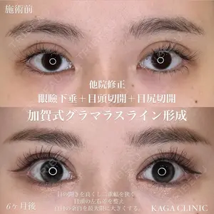 before image