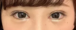 30 days after image