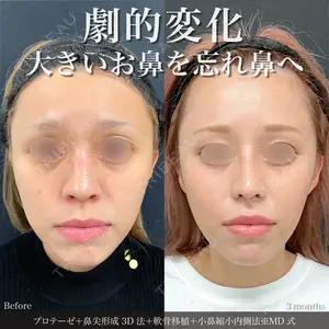 90 days after image