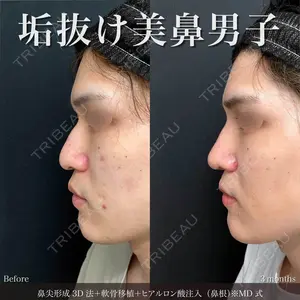 90 days after image