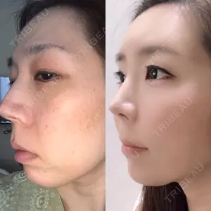 90 days after image