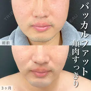 90 days after image