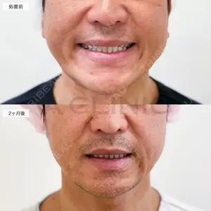 60 days after image