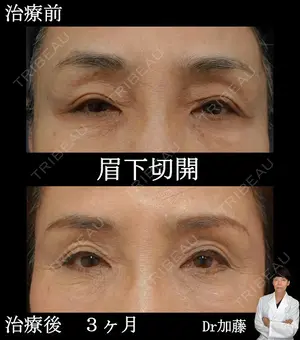 90 days after image