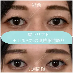 7 days after image
