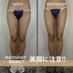 90 days after image