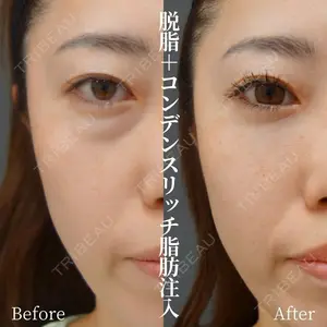 before image