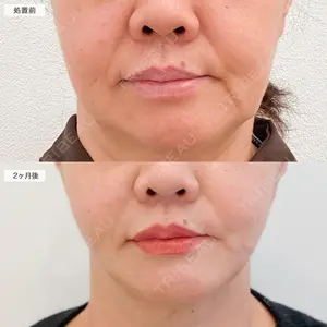 60 days after image