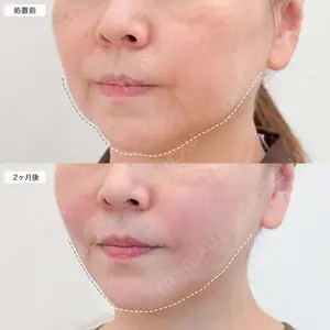 60 days after image