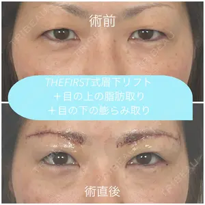0 days after image