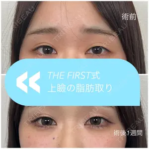 7 days after image