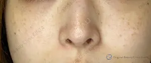 30 days after image